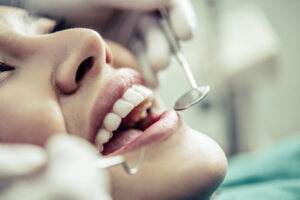 dentista tenerife - dientes